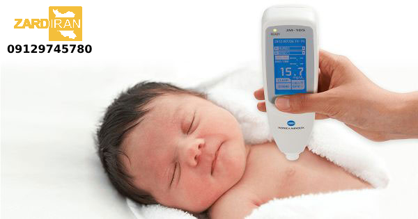 تشخیص زودهنگام زردی نوزاد