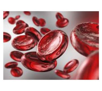 زردی ناشی از ناسازگاری موجود در خون نوزادان