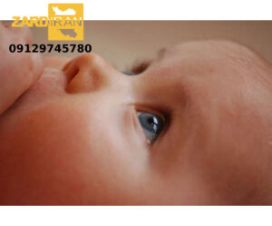 درمان سریع زردی نوزاد