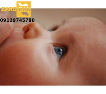 درمان سریع زردی نوزاد